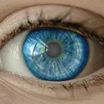 ochi cu cataracta